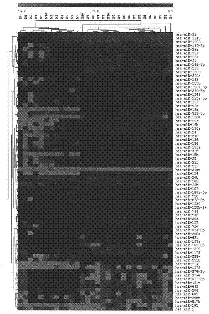 Application of microRNA-320(miR-320A) and its antisense nucleotide in diagnosis, prevention and treatment of cardiovascular diseases