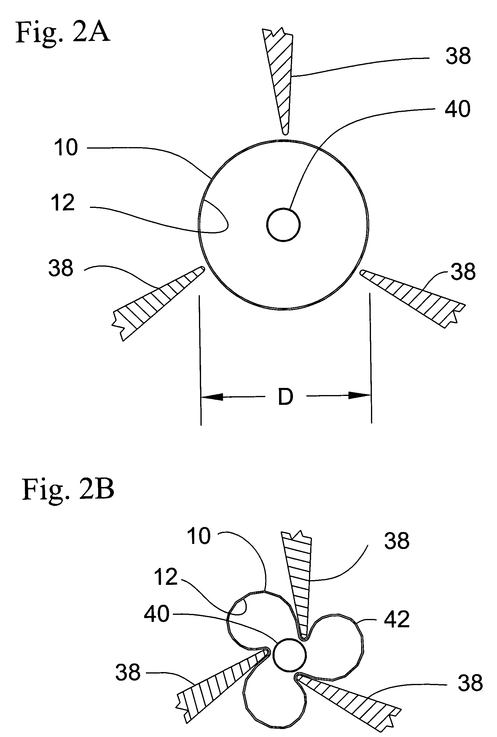 Pleated stent assembly