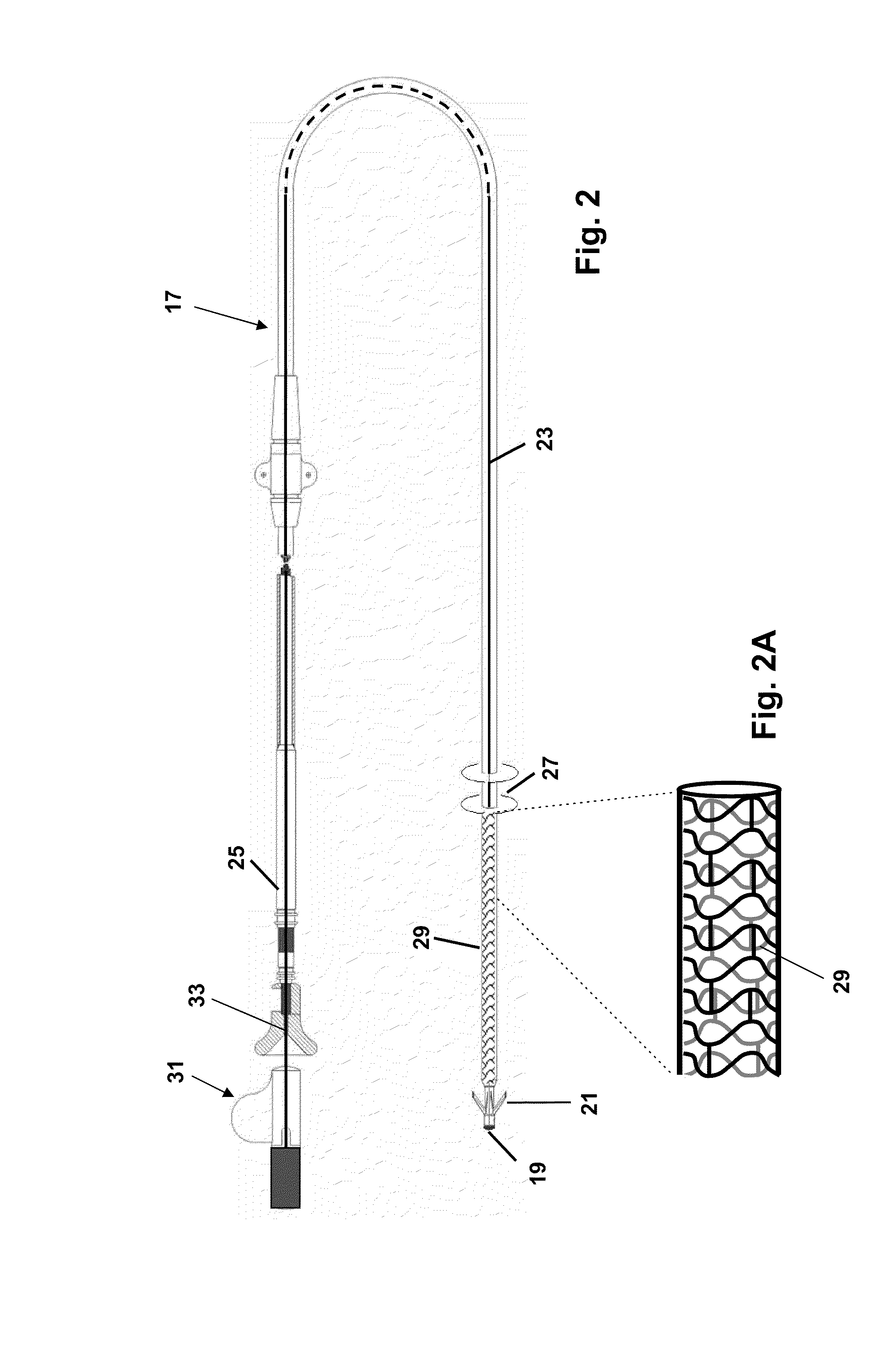 Implantable line