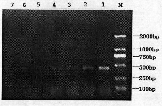 Kit for diagnosing reovirus genes of grass carps and application thereof