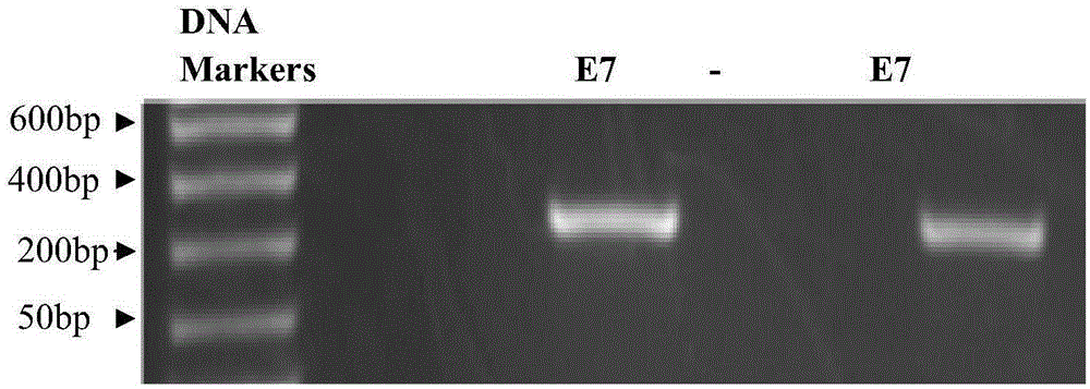 Recombinant adeno-associated viral vector with human papillomavirus type 16 multi-point mutant E7&lt;mm&gt; antigen genes, method for constructing recombinant adeno-associated viral vector and application thereof