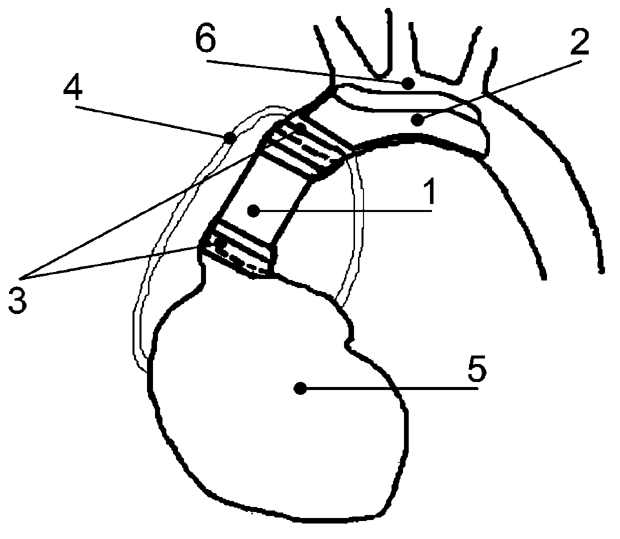 Auxiliary circulation blood pump adopted in serially connecting operation modes and installing method of auxiliary circulation blood pump