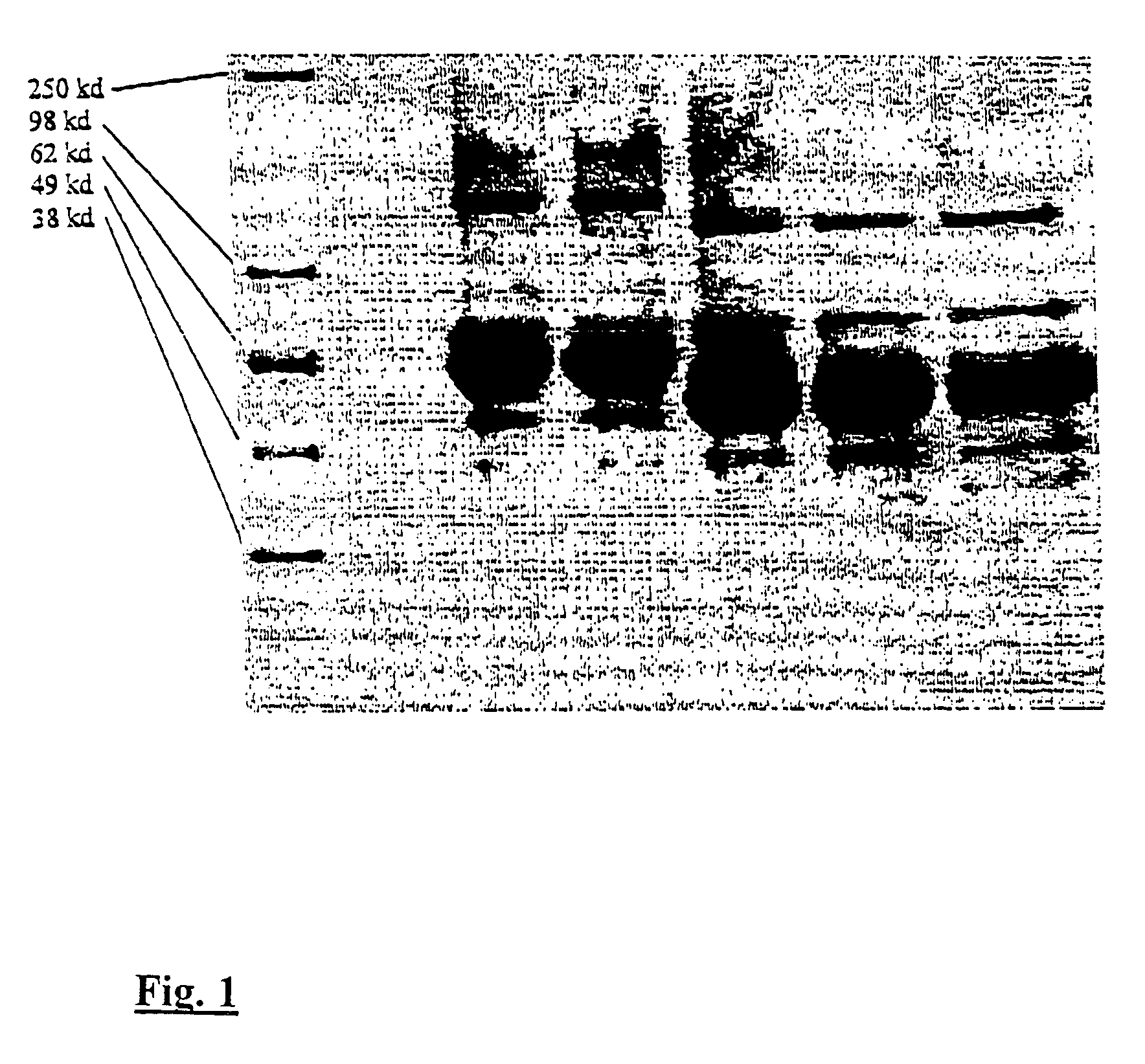 Erythropoietin forms with improved properties