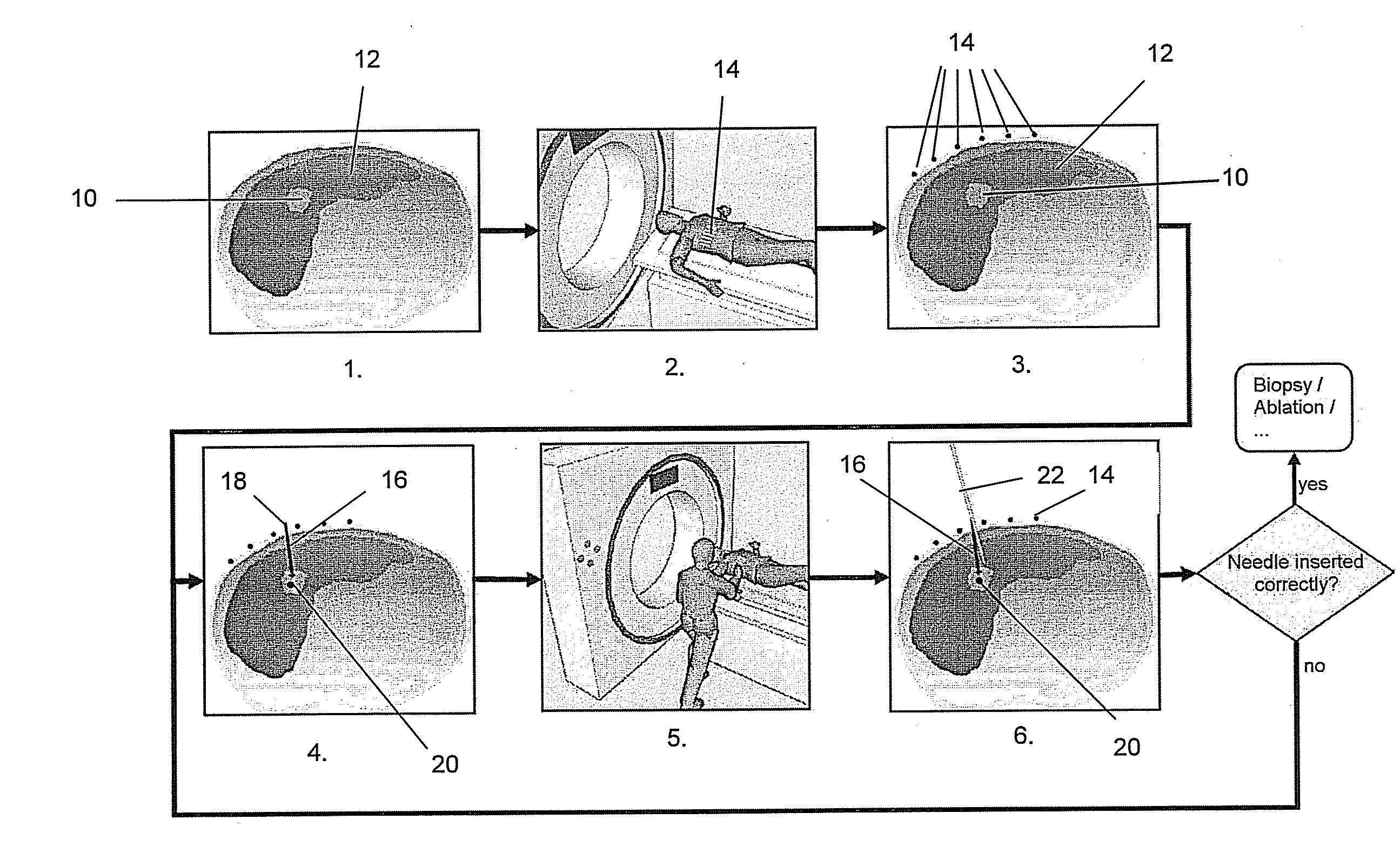 Method, system and computer program product for targeting of a target with an elongate instrument