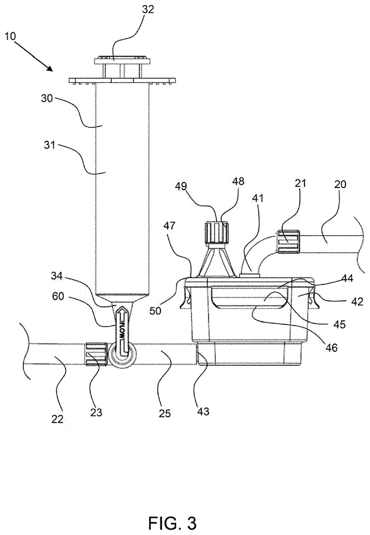 Manual clot aspiration and filtration system and method of removing a clot