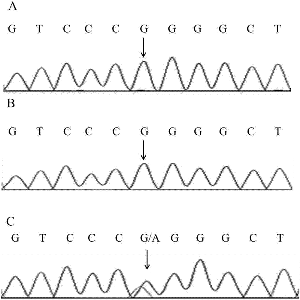 Pathogenic gene mutation of hypothyroidism and diagnostic reagent based on same