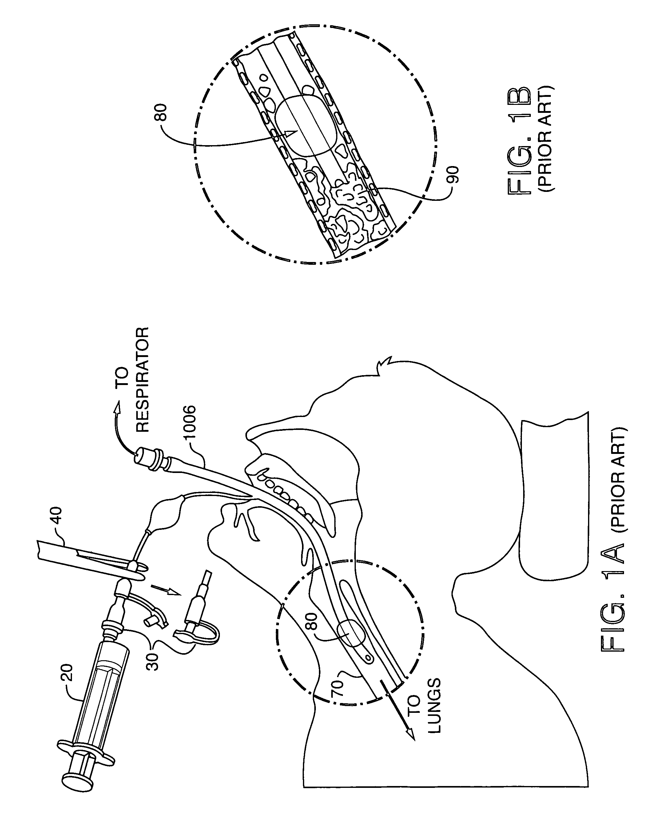 Methods, devices and formulations for targeted endobronchial therapy