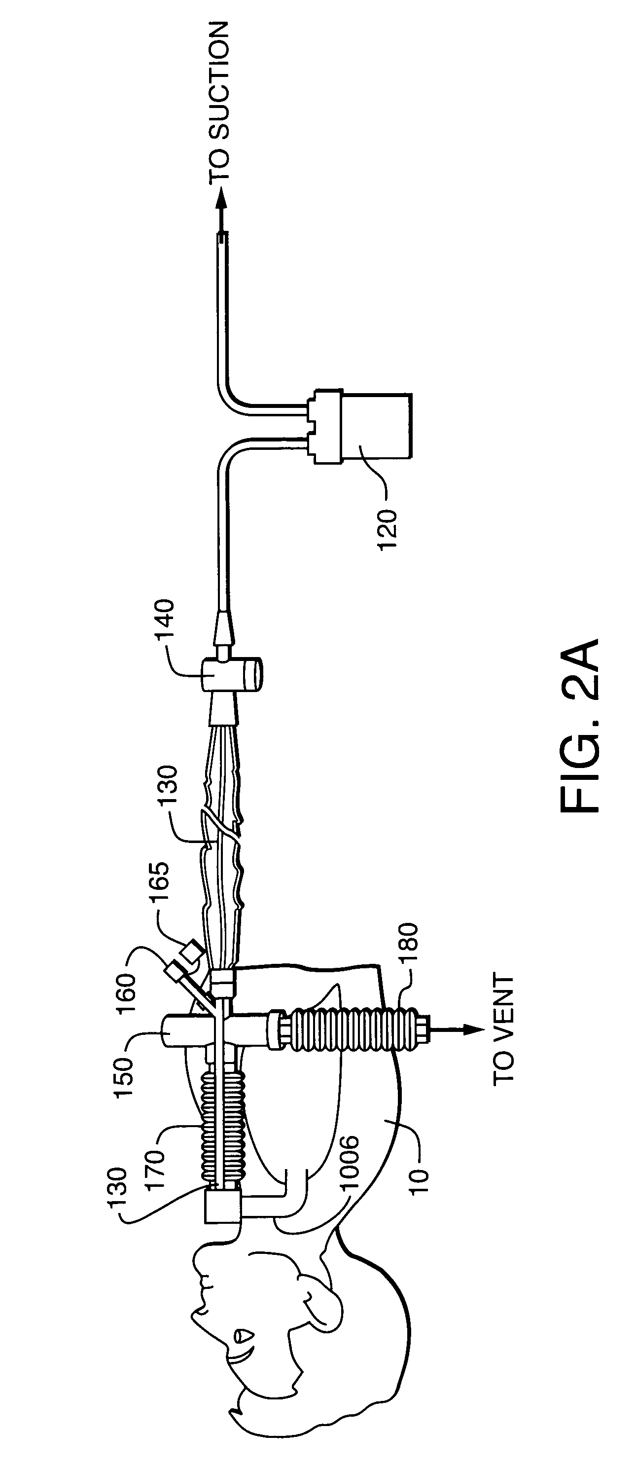 Methods, devices and formulations for targeted endobronchial therapy