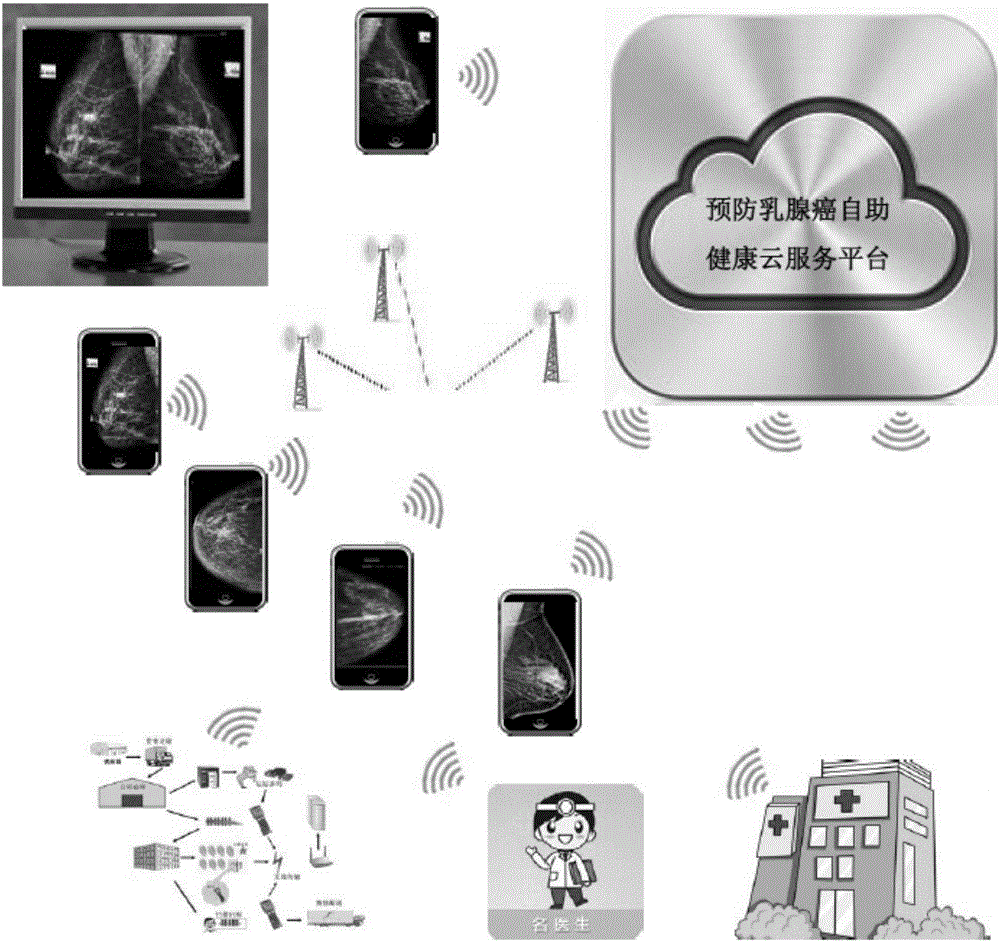 Breast cancer prevention self-service health cloud service system based on deep convolutional neural network