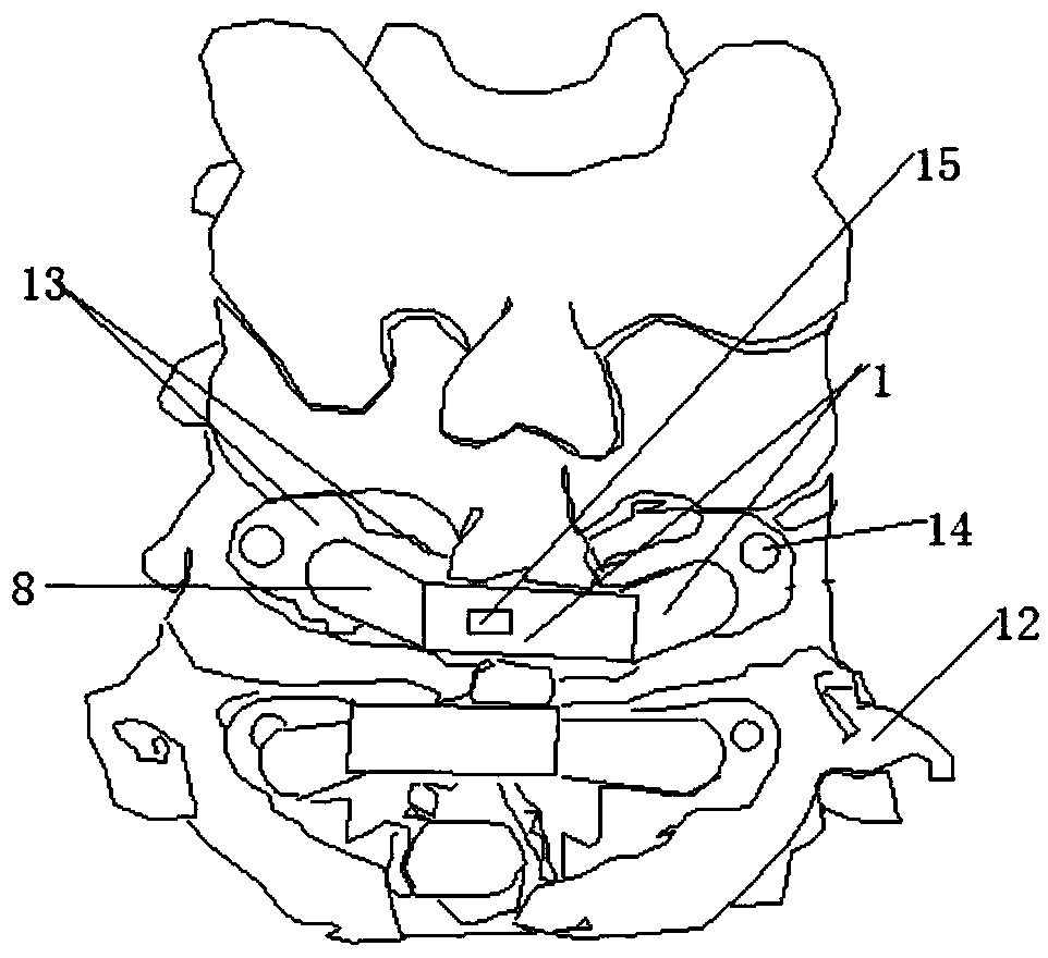 Personalized cervical vertebrae pedicle screw step-by-step navigation template device and making method thereof