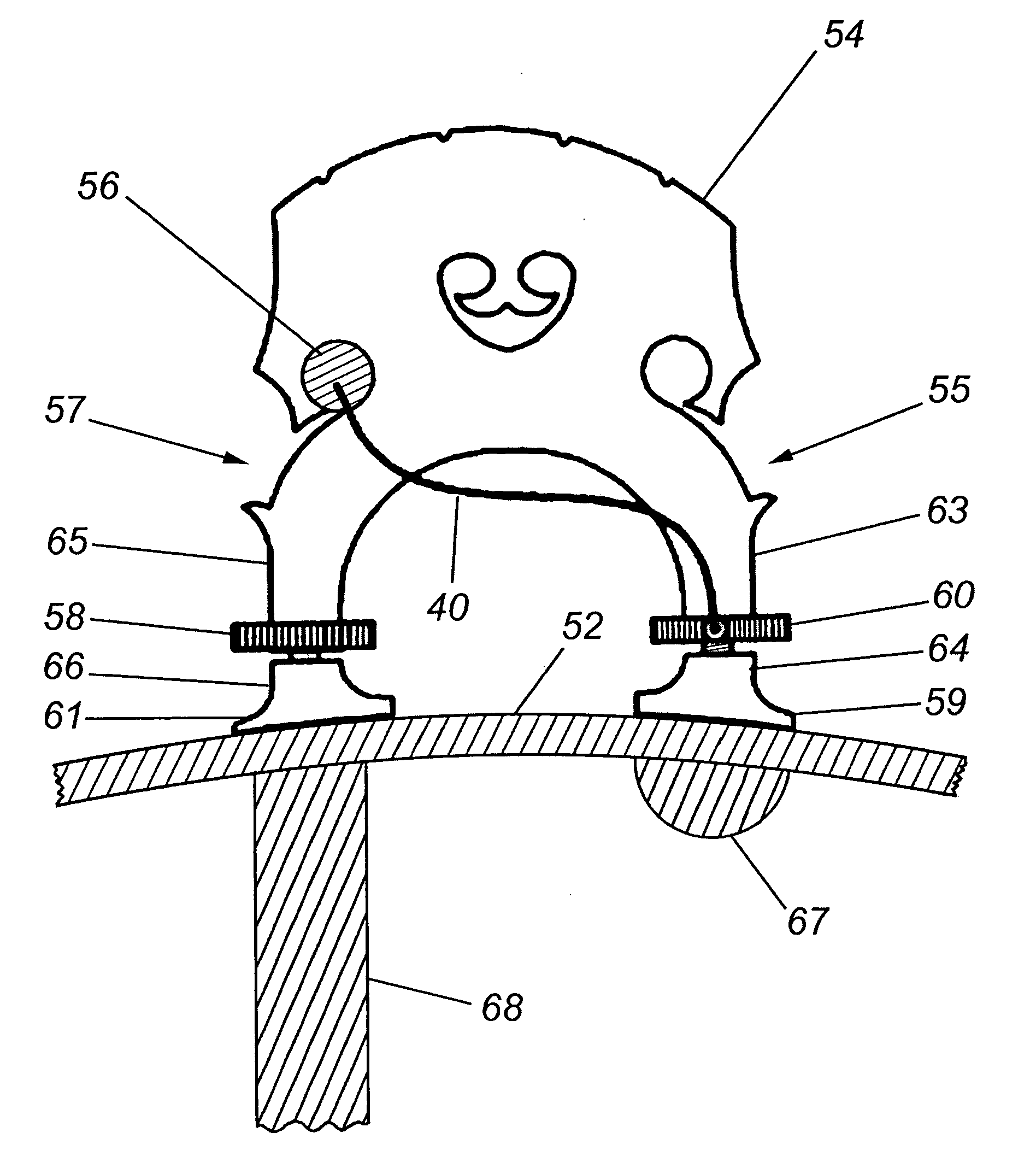 Musical instrument transducer