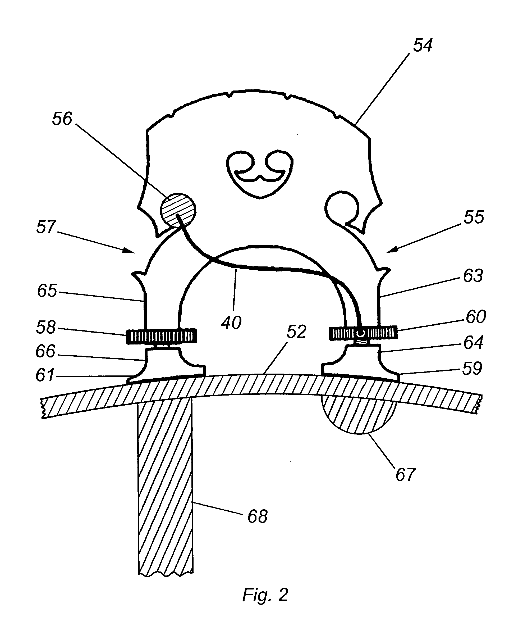 Musical instrument transducer