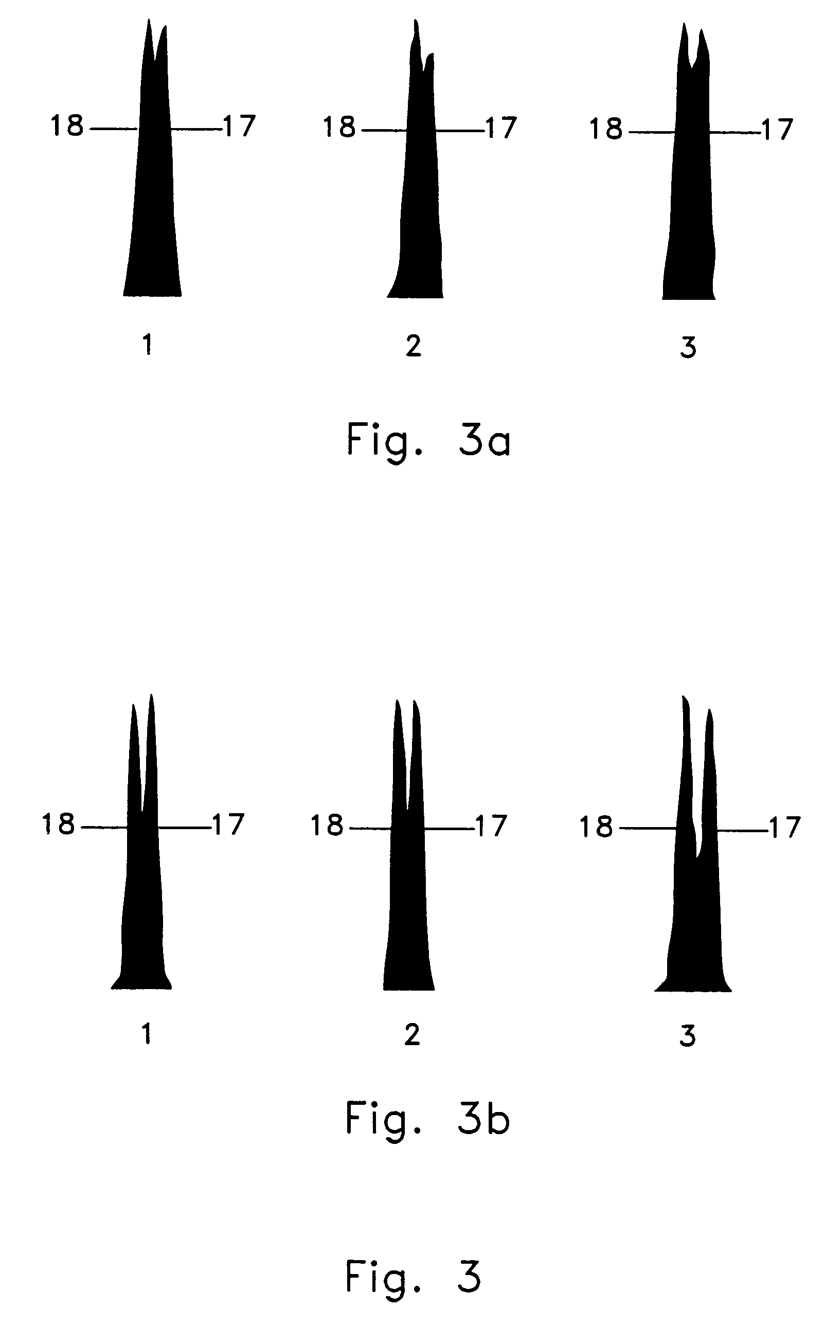 High purity X-chromosome bearing and Y-chromosome bearing populations of spermatozoa