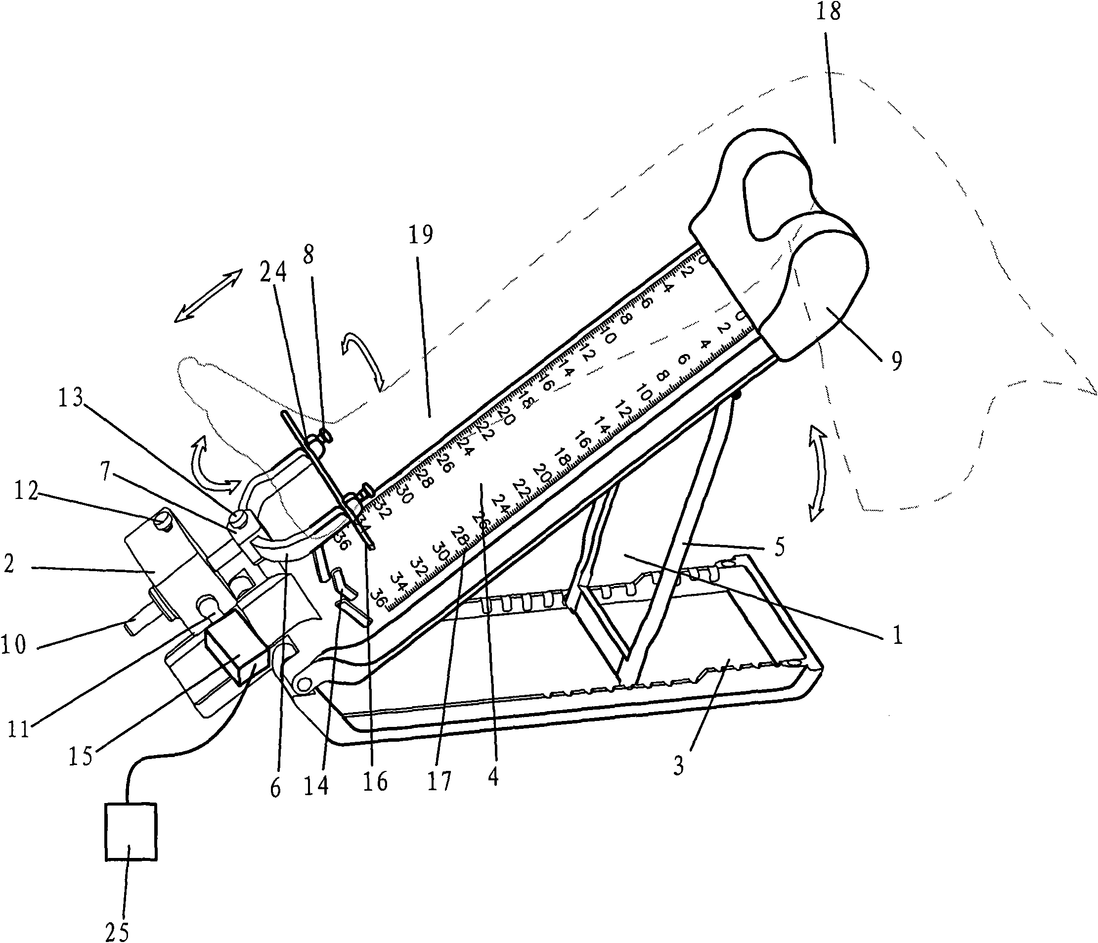 Novel orthopedics restoration device