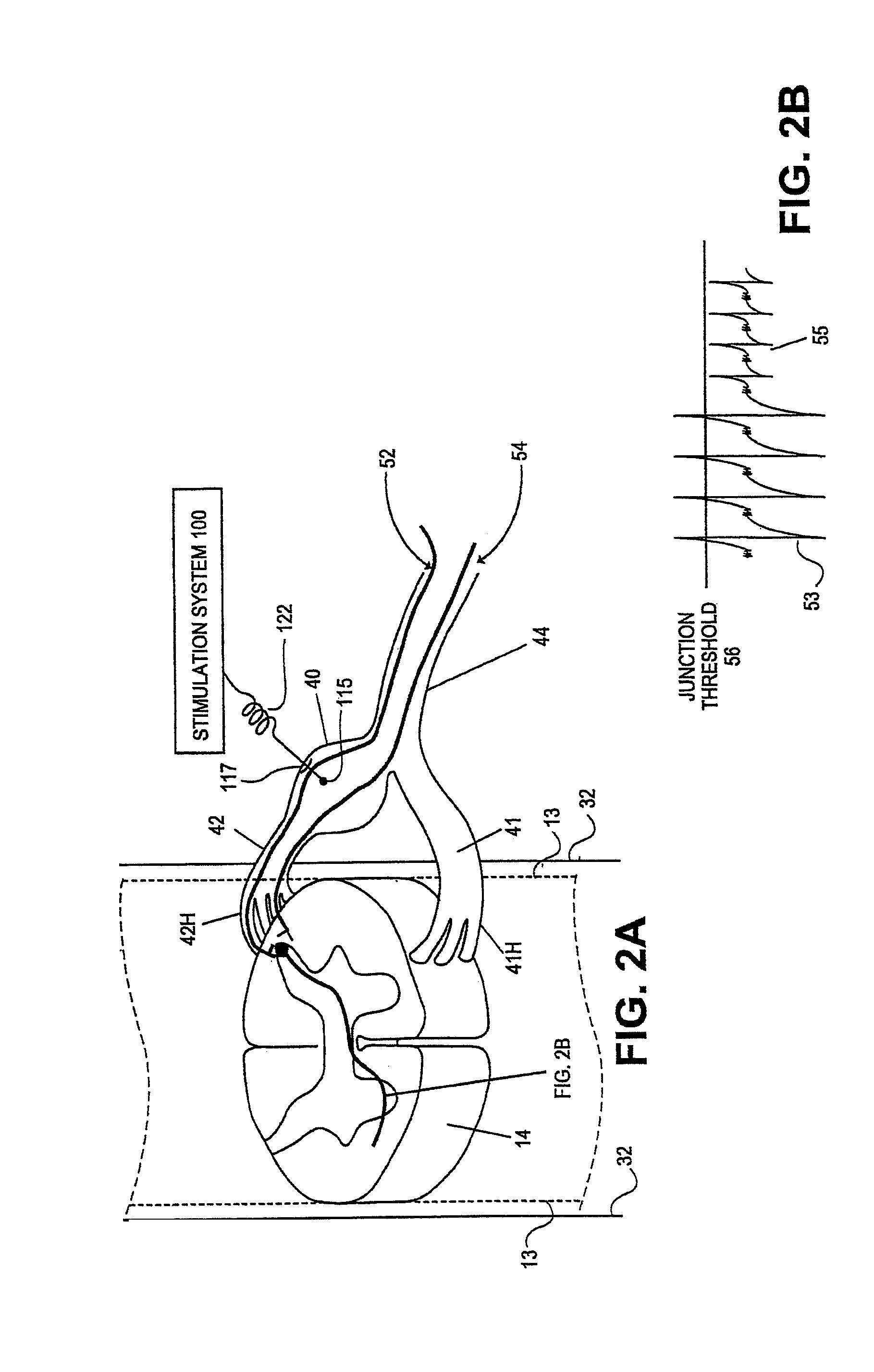 Neurostimulation methods and systems