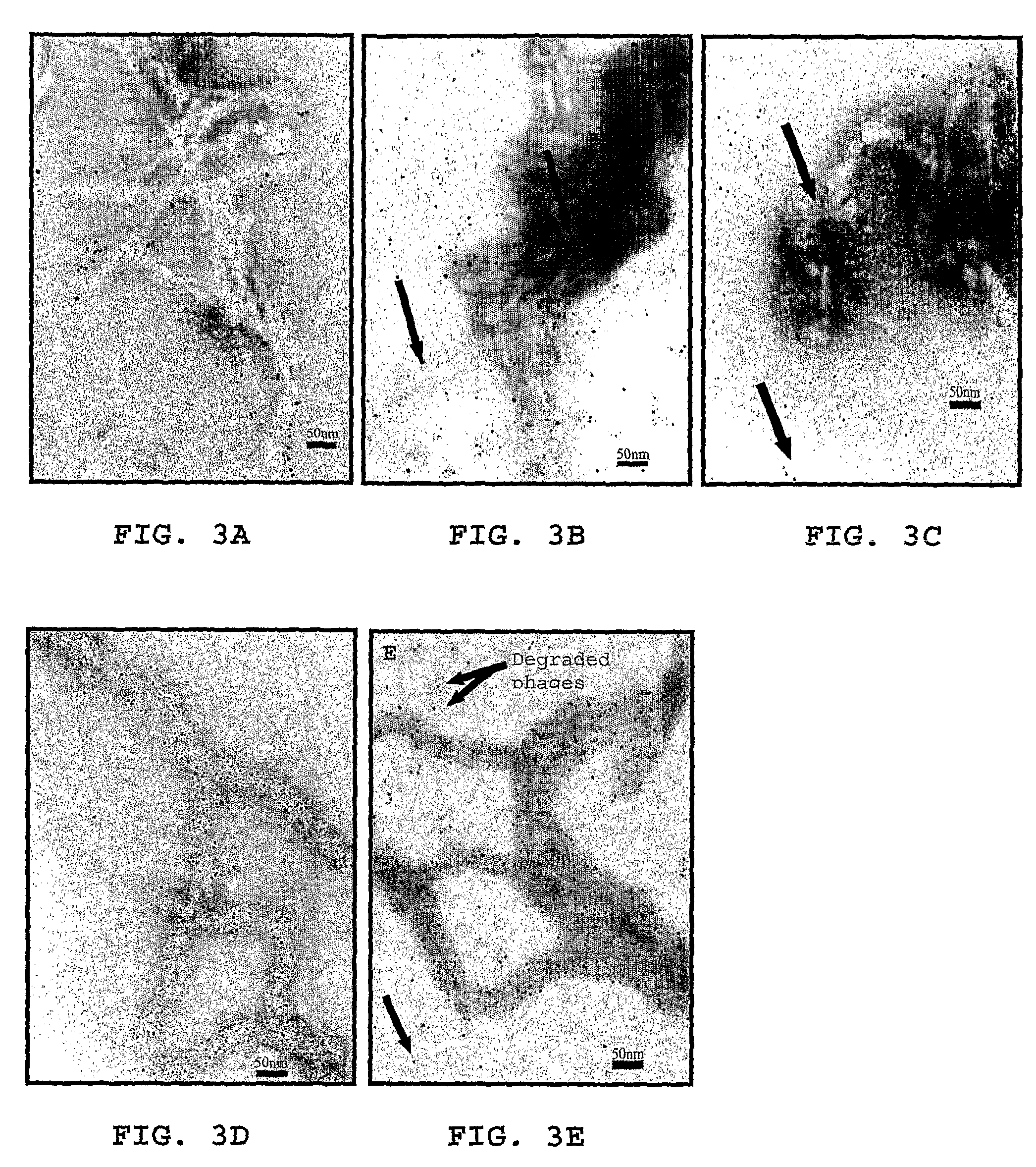 Method for treating inflammation associated with amyloid deposits and brain inflammation involving activated microglia