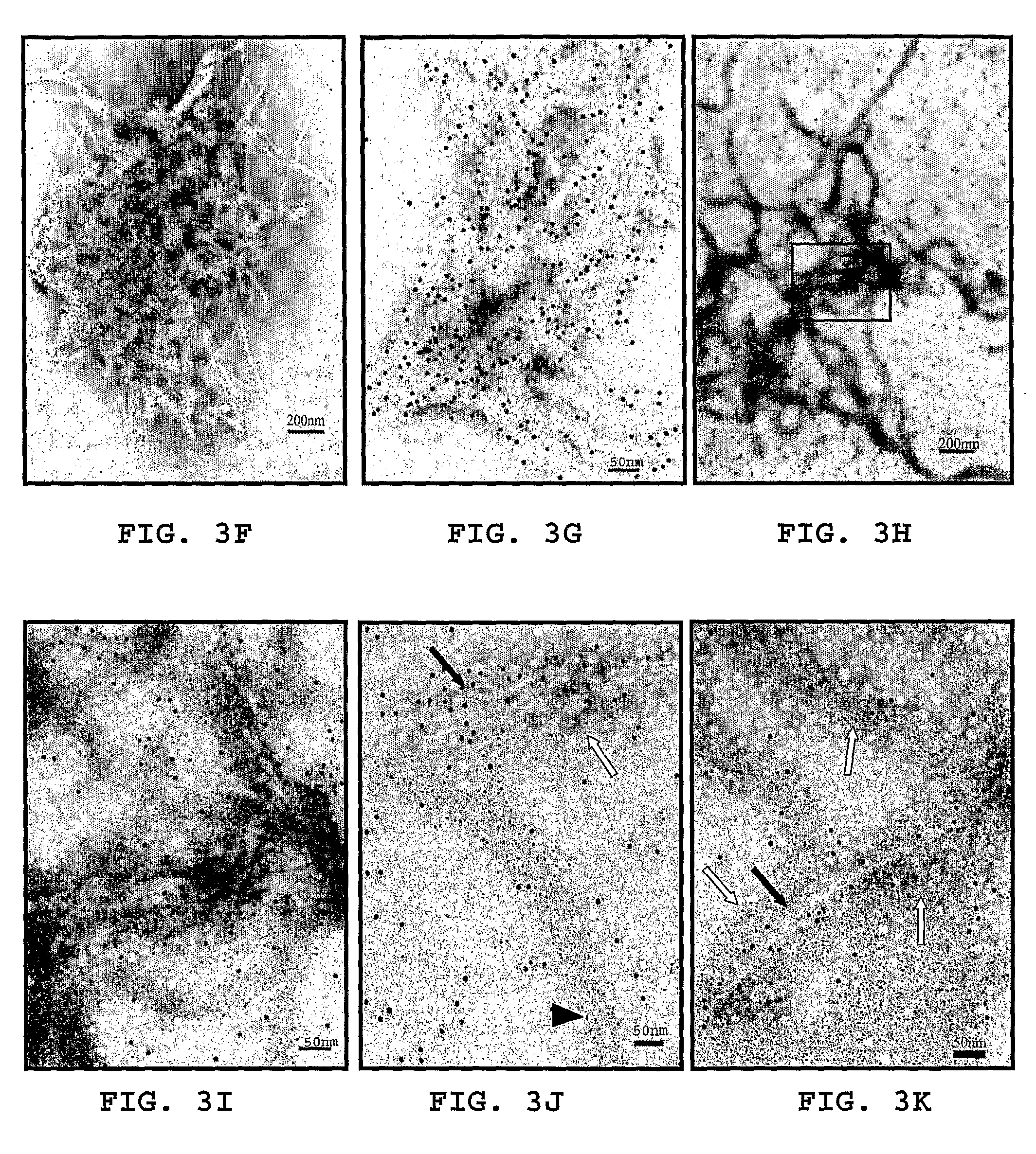 Method for treating inflammation associated with amyloid deposits and brain inflammation involving activated microglia