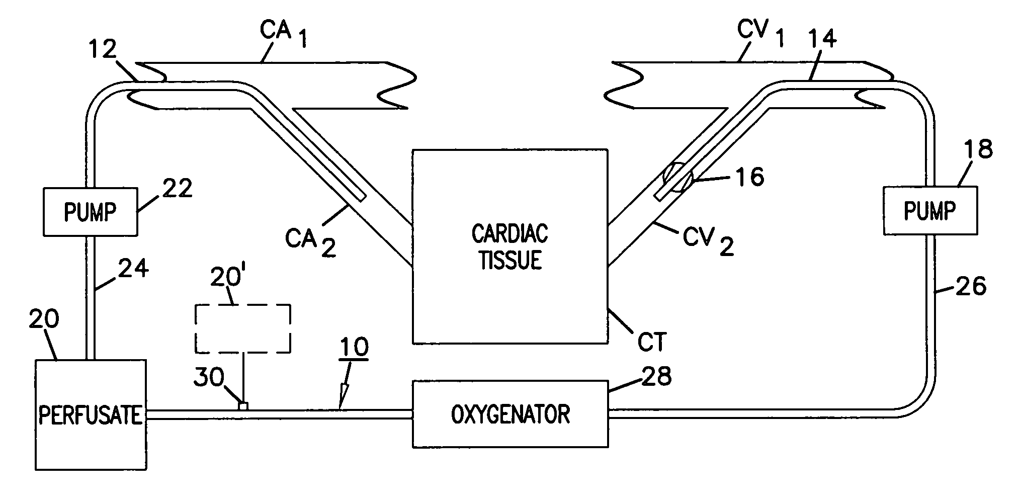 Regional cardiac tissue treatment