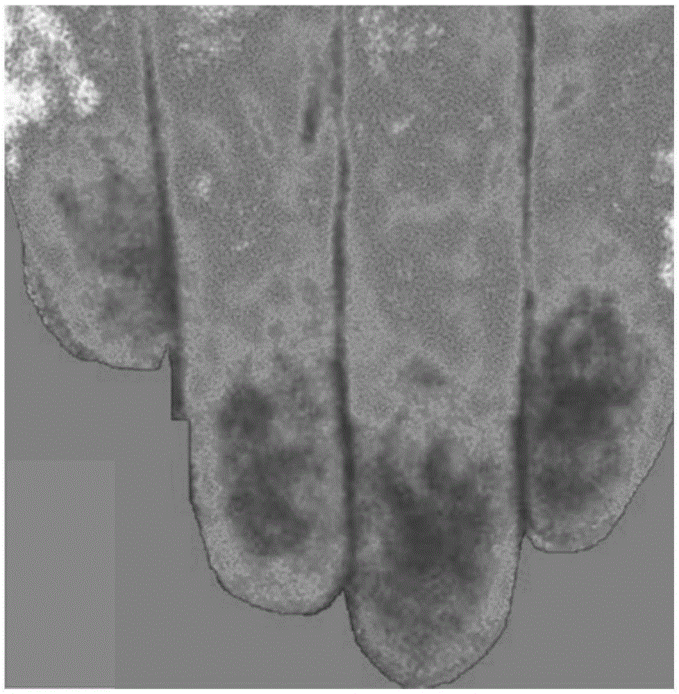 Quantitative imaging device and method used for laser speckle blood flow velocity