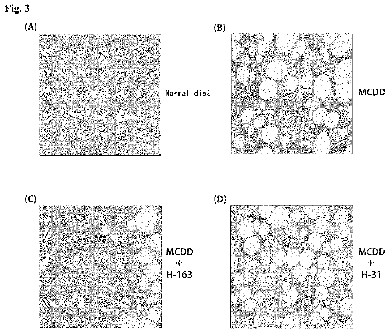 Therapeutic Agent for Fatty Liver Diseases and Therapeutic Agent for Adiposity