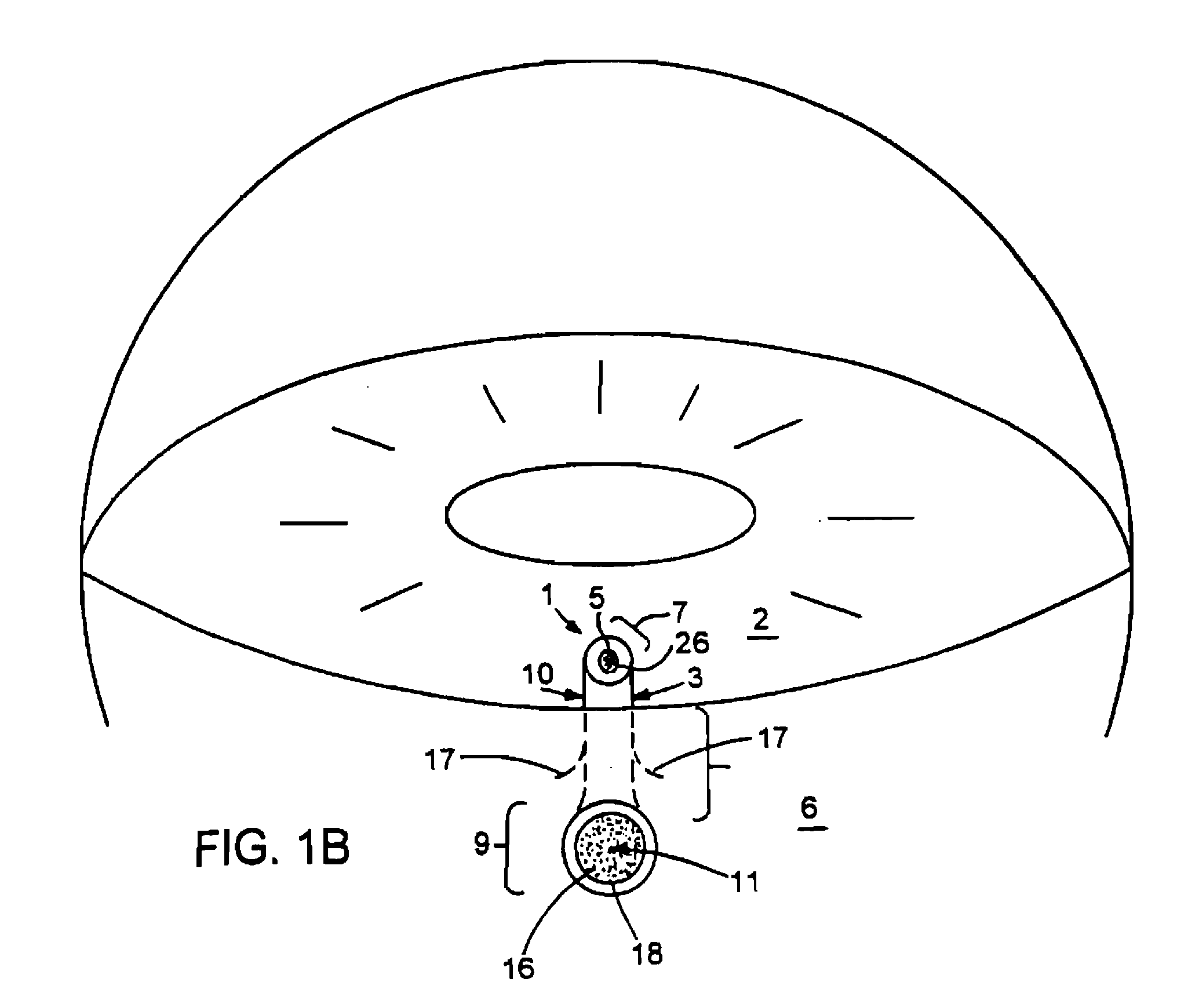 Glaucoma Treatment Devices and Methods