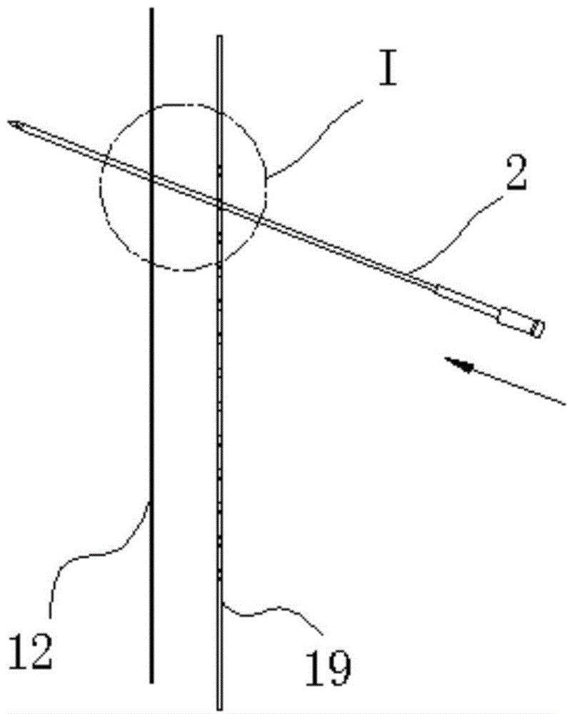 Adjusting type medical template system