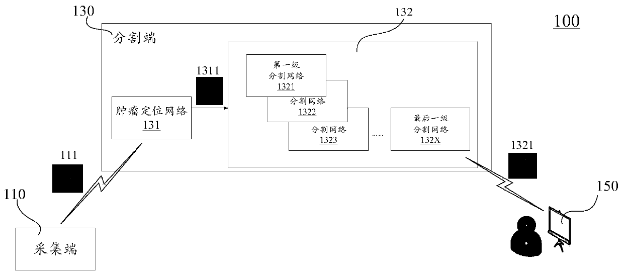 Image segmentation method, device, diagnosis system and storage medium