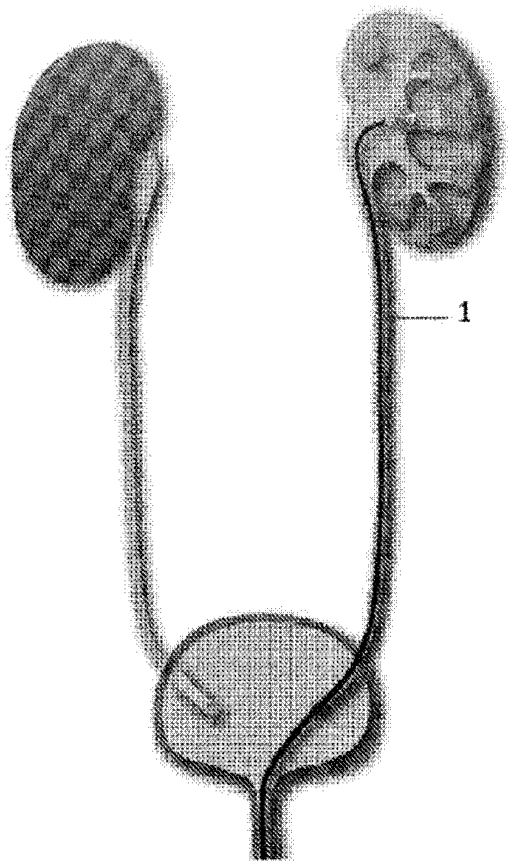 Methods of treating upper tract urothelial carcinomas