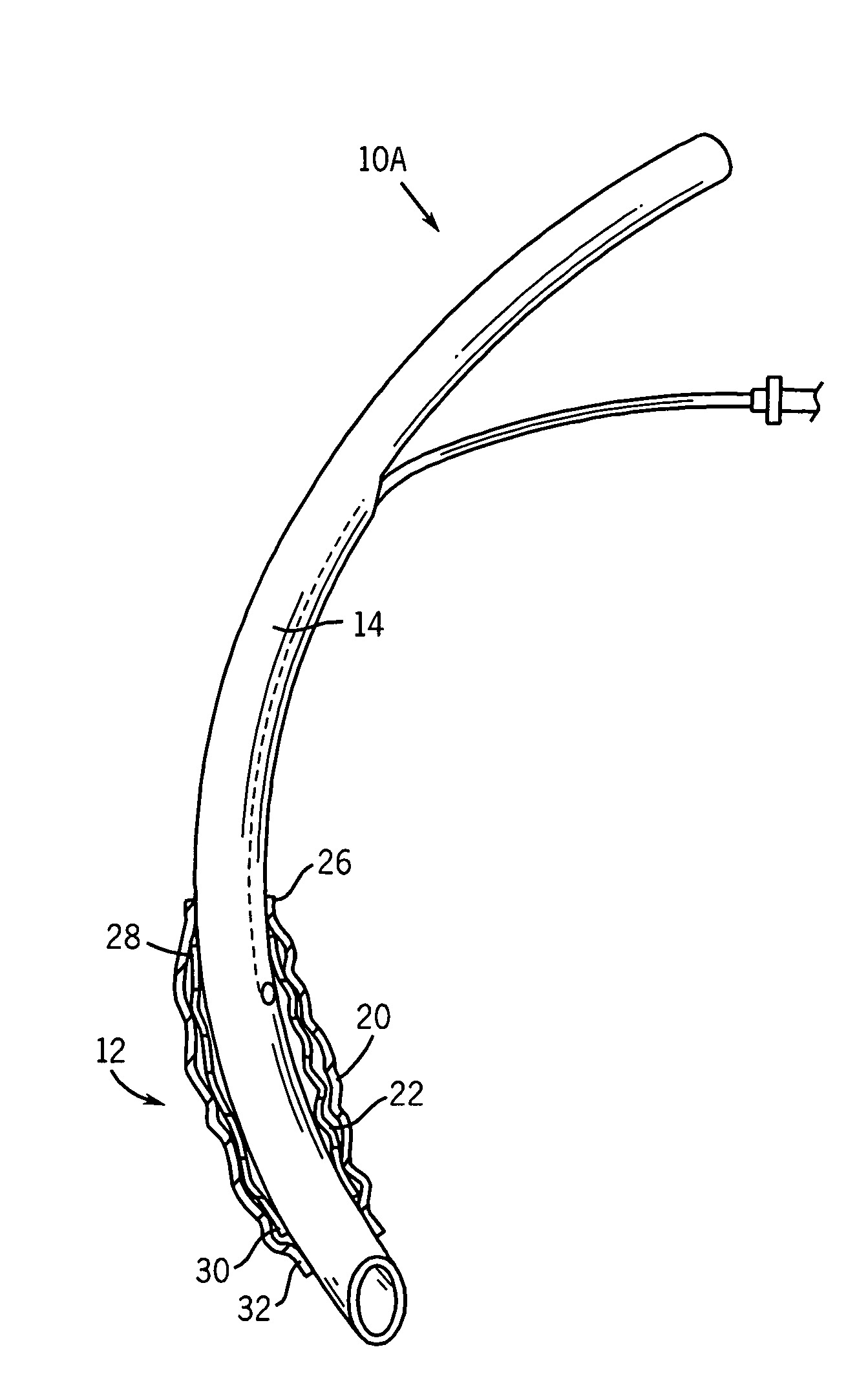 Endotracheal cuff and technique for using the same