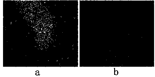 Tissue-engineered bone and preparation method thereof