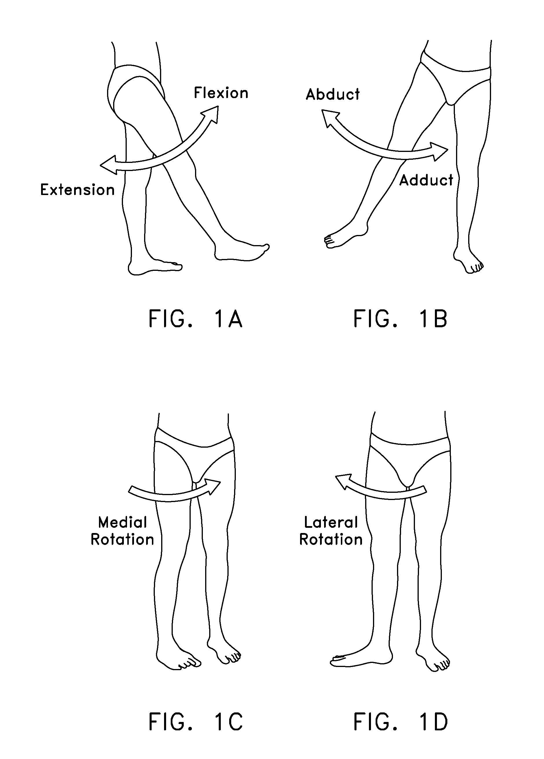 Laterally-expandable access cannula for accessing the interior of a hip joint