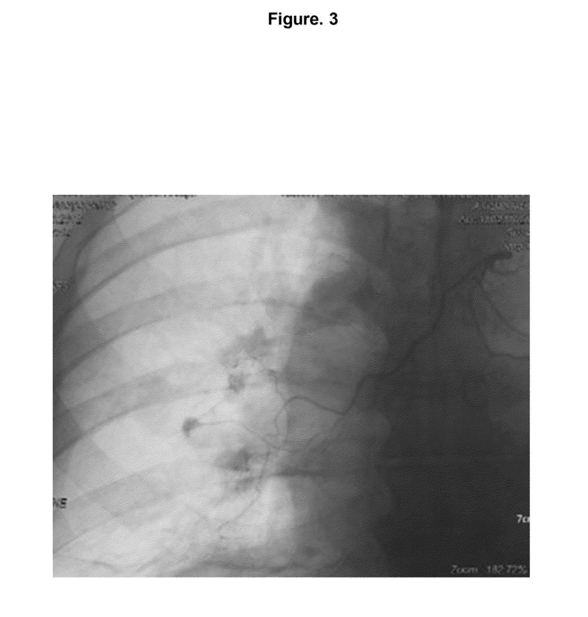 Method for Treating Lung Carcinoma