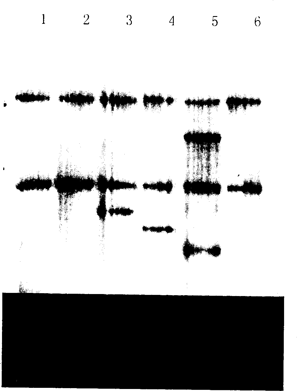 Tobacco calmodulin dependent protein kinase gene, protein and its prepn and application