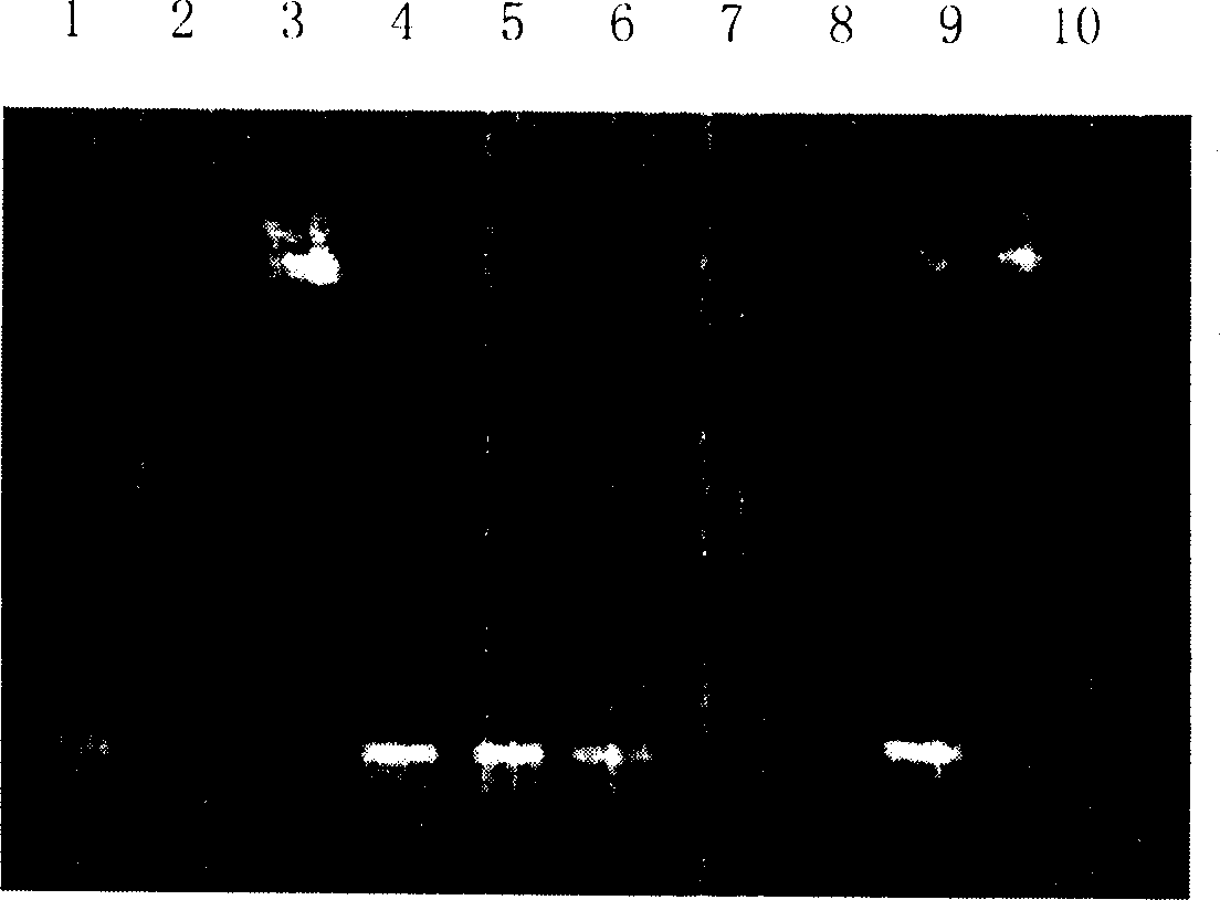 Tobacco calmodulin dependent protein kinase gene, protein and its prepn and application