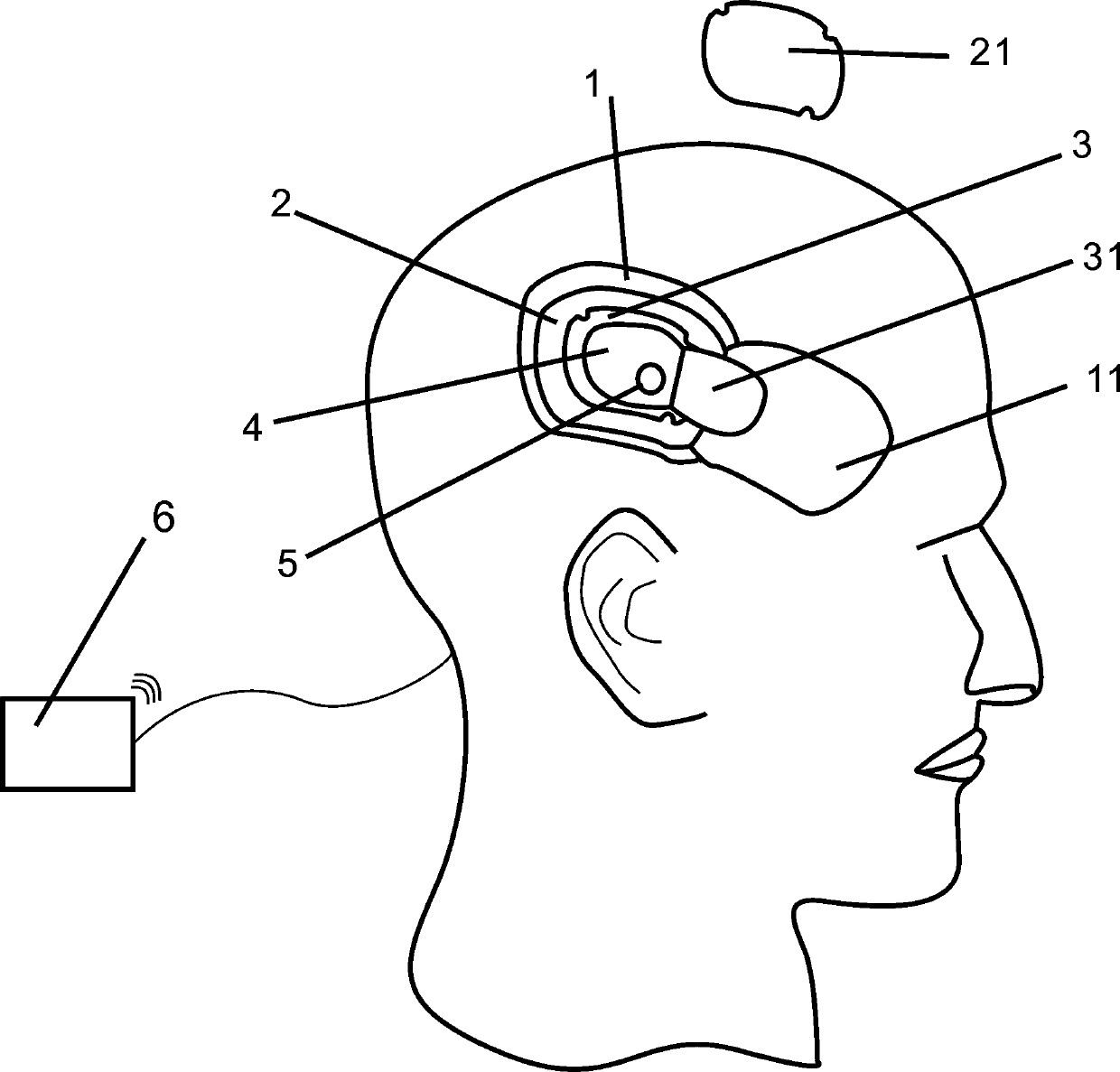 Craniotomy training device having interlayer positioning putting device