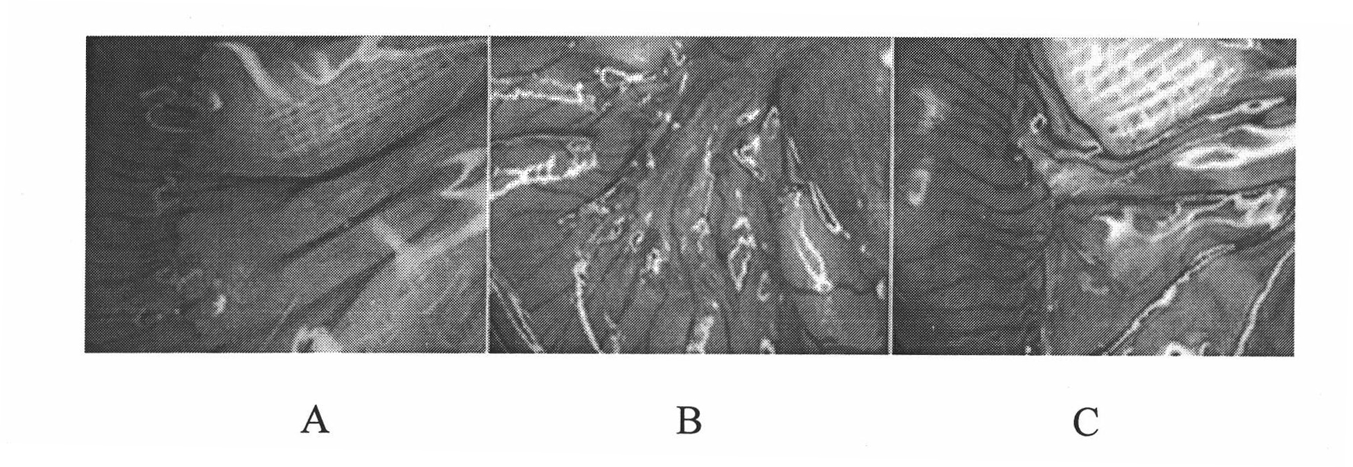 Medicament for preventing and treating small intestine transplantation chronic rejection and application thereof