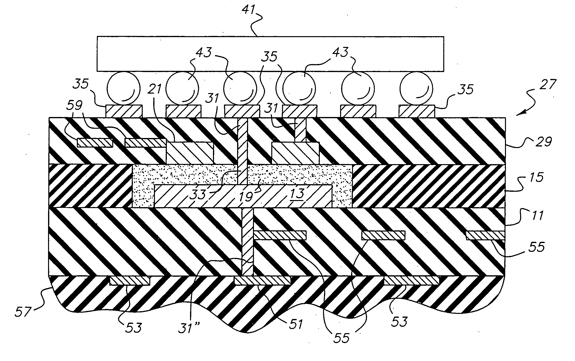 Capacitor material with metal component for use in circuitized substrates, circuitized substrate utilizing same, method of making said circuitized substrate, and information handling system utilizing said circuitized substrate