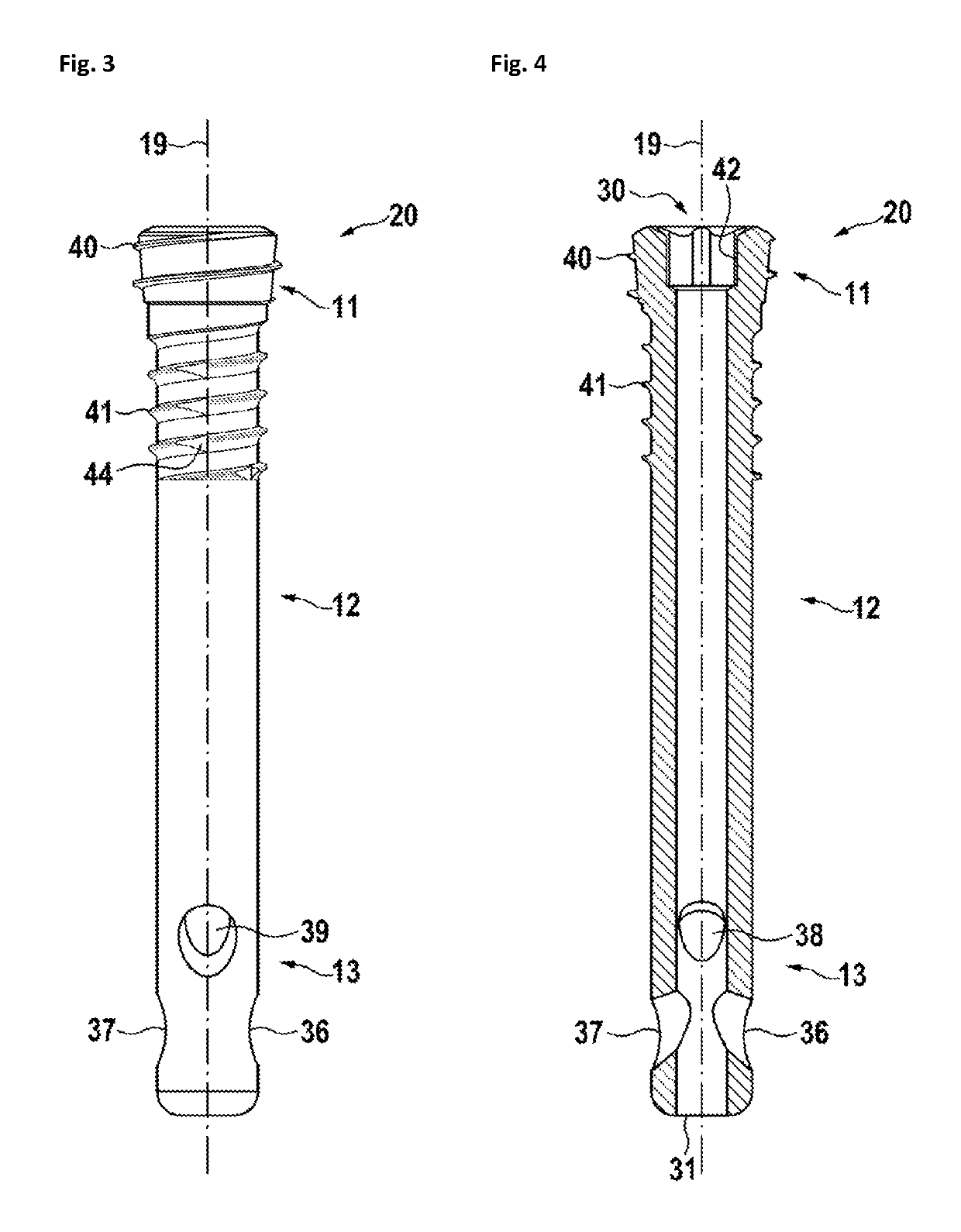 Cannulated bone screw