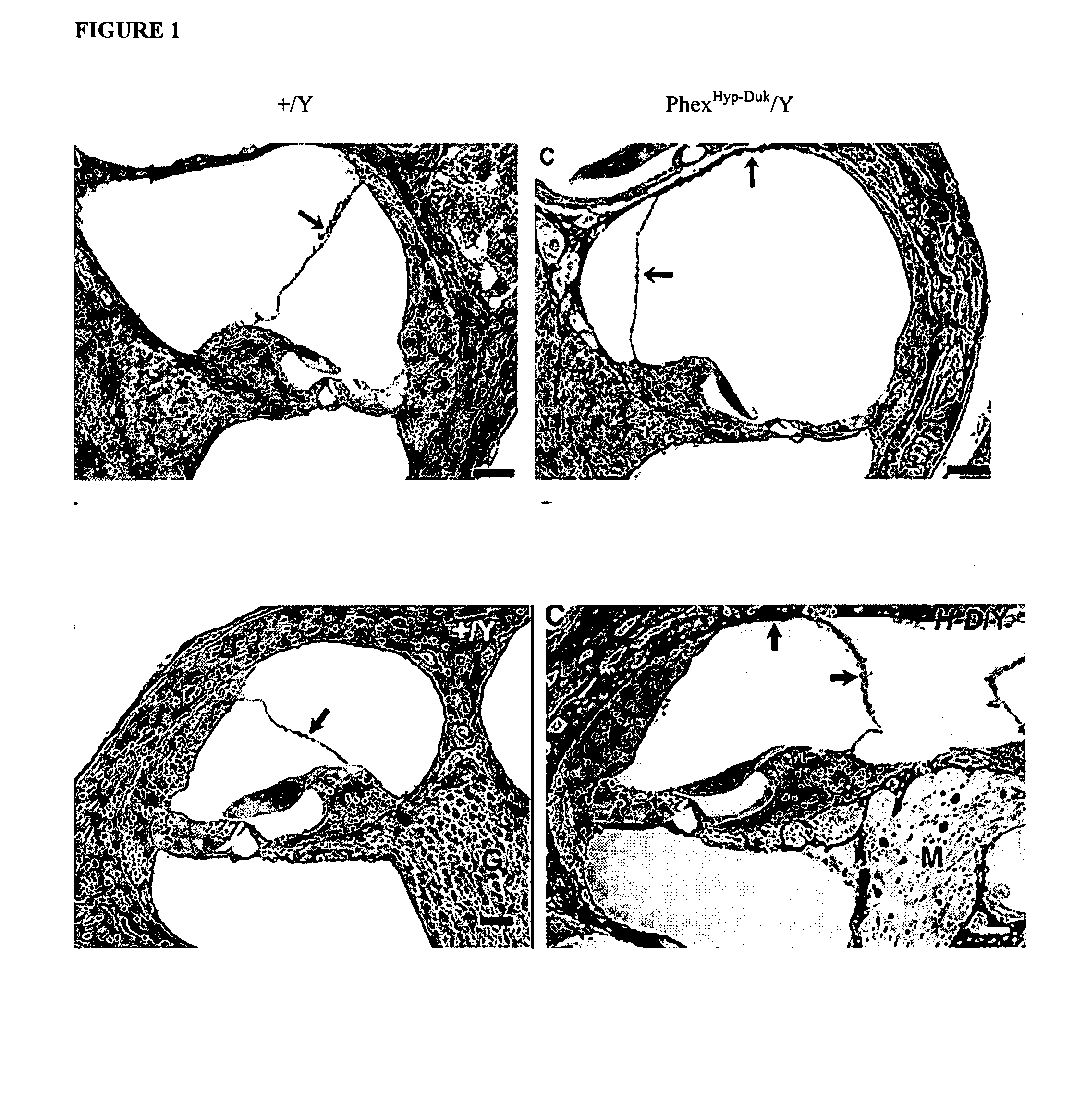 Methods and compositions for neuroprotection