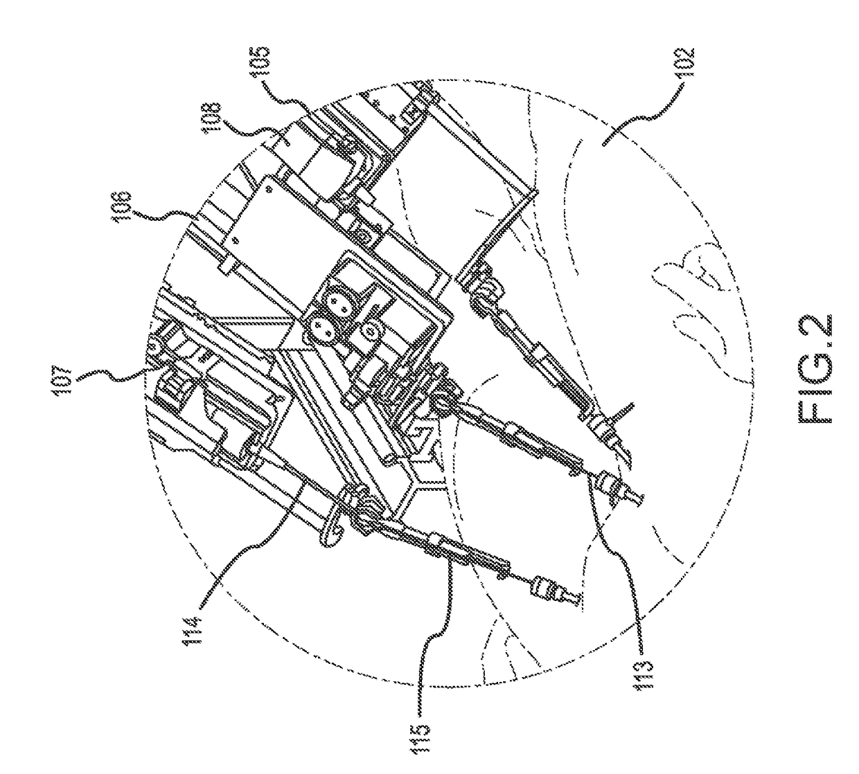 Suspension system for remote catheter guidance