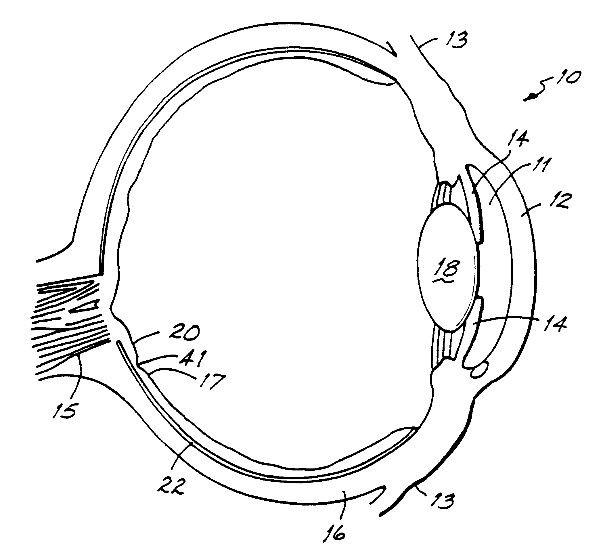 Method of ocular treatment