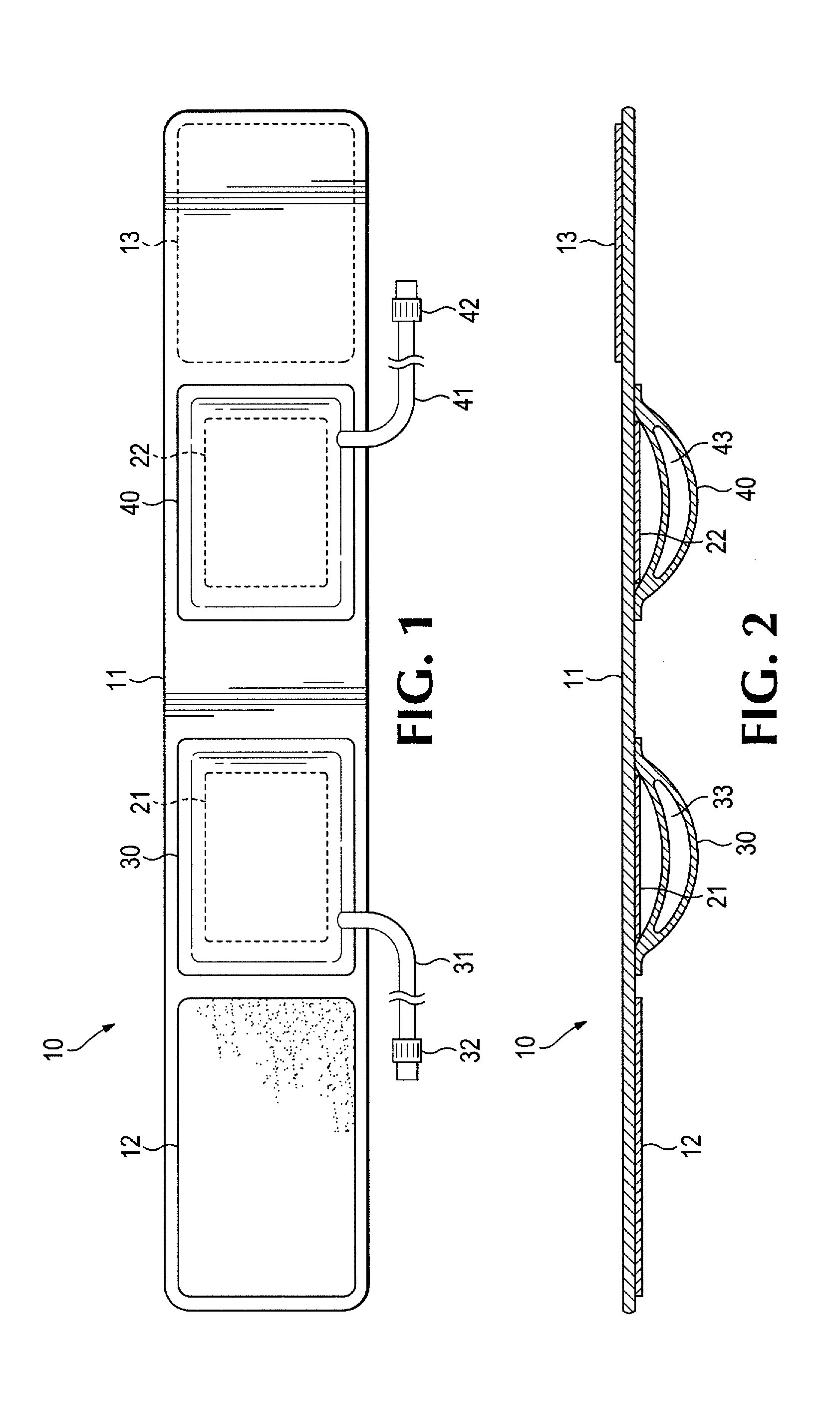 Apparatus and Method of Use for an Adjustable Radial and Ulnar Compression Wristband