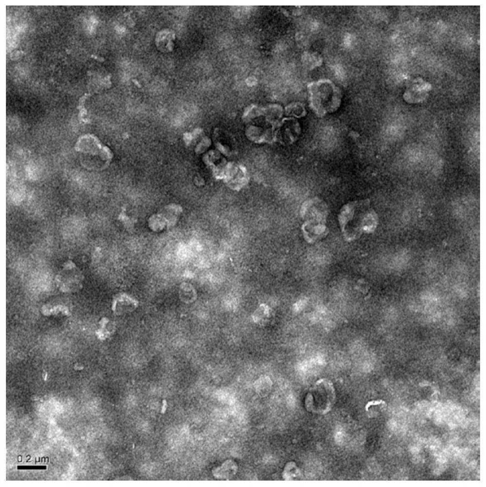 Simple and convenient exosome extraction method