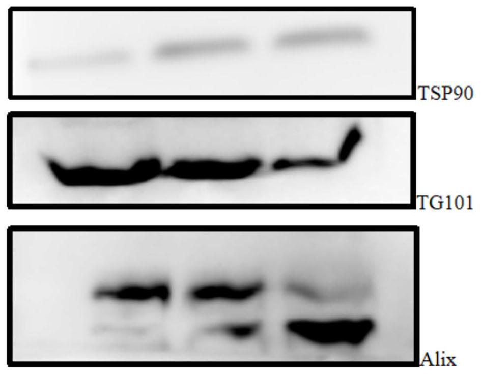 Simple and convenient exosome extraction method