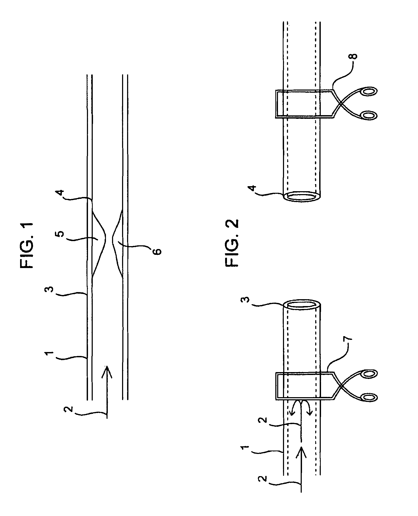 Compositions and methods for joining non-conjoined lumens