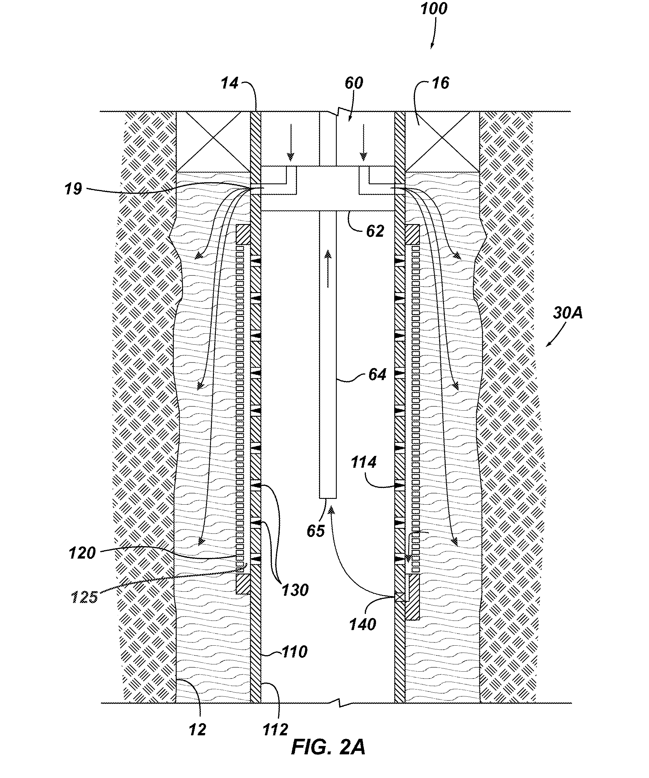 High-Rate Injection Screen Assembly with Checkable Ports