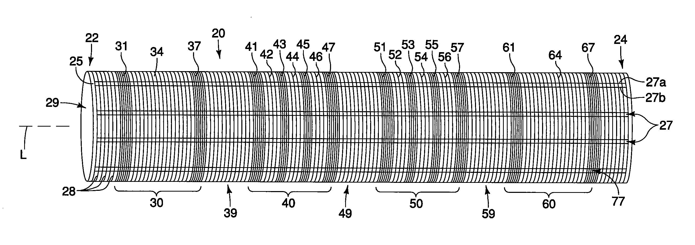 Medical prostheses having bundled and non-bundled regions