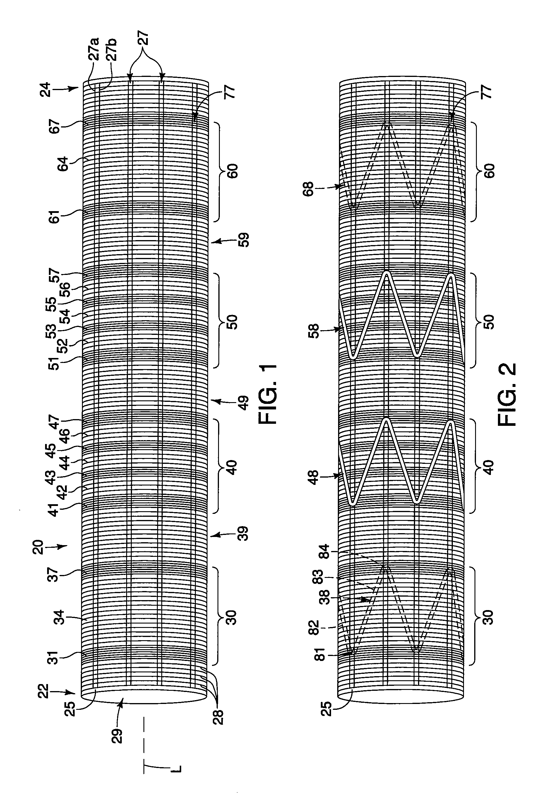 Medical prostheses having bundled and non-bundled regions