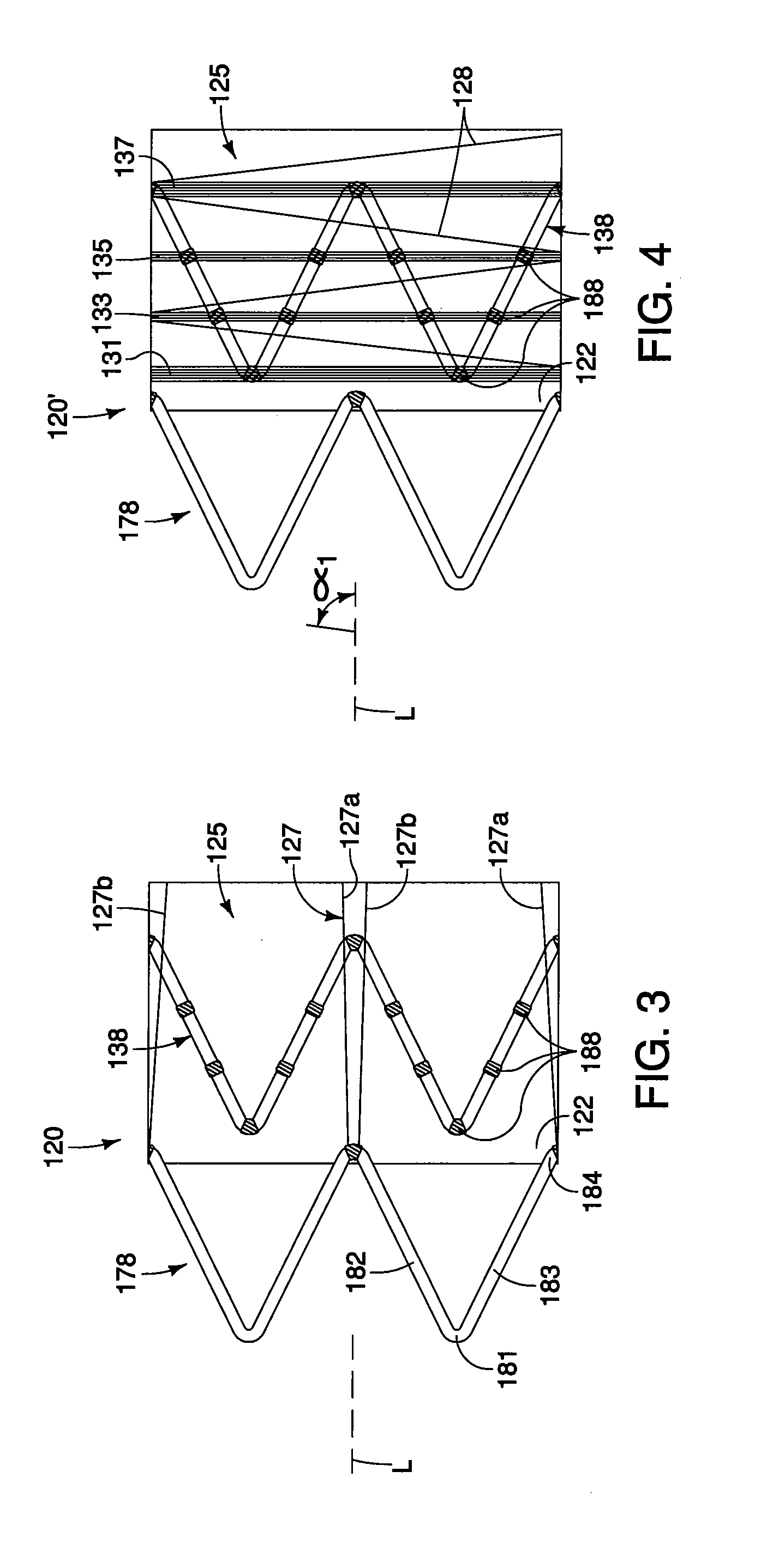 Medical prostheses having bundled and non-bundled regions