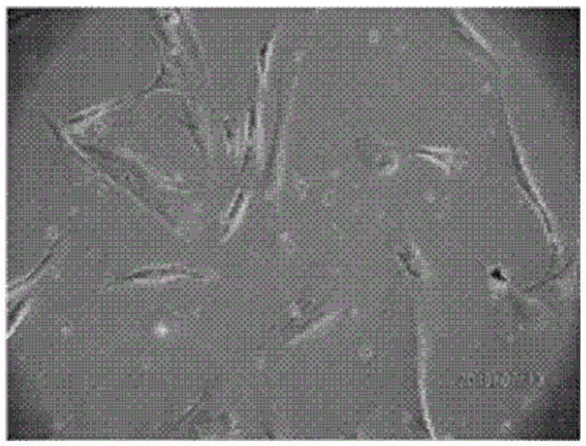 Stem cell culture medium and method for culturing endometrium stem cells